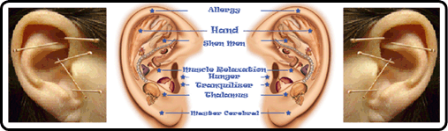 Spinal Acupuncture