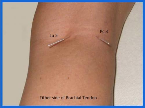 student_pic_0025_brachial_tendon