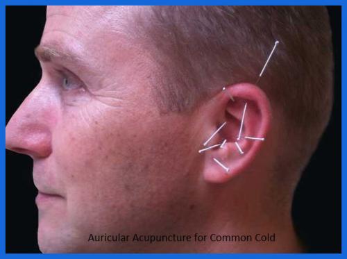 student_pic_0028_auricular_points