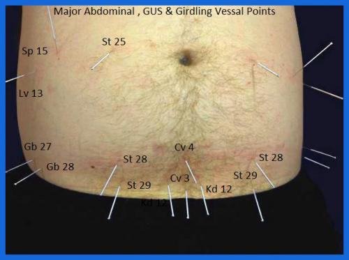 student_pic_0039_acupuncture_stomach